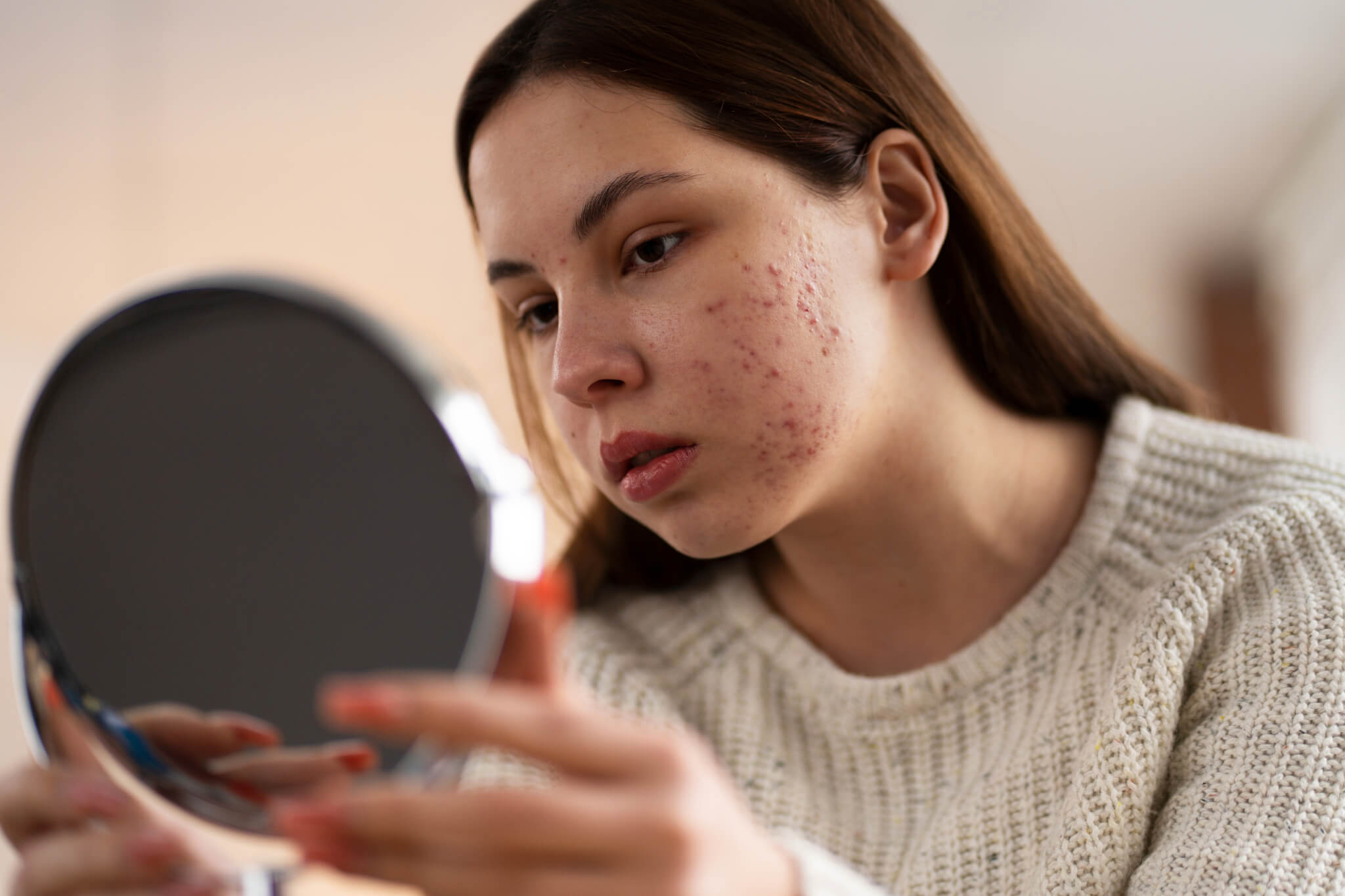 Acne & Rosacea Treatments in New York, NY: Expert Care at DermArtisan MedSpa