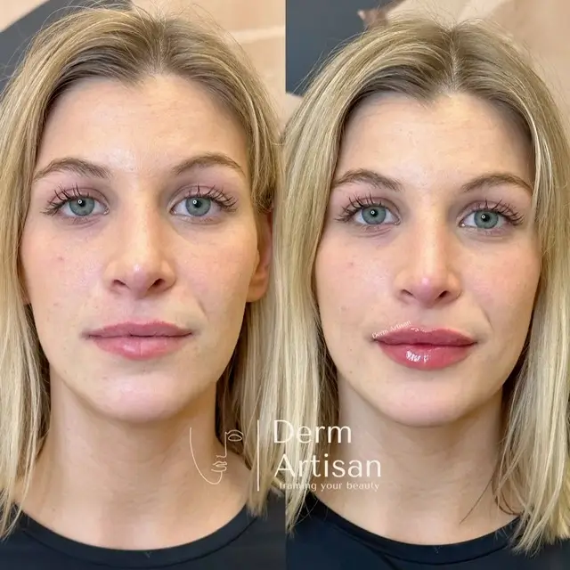 Home 32 photo-output-7