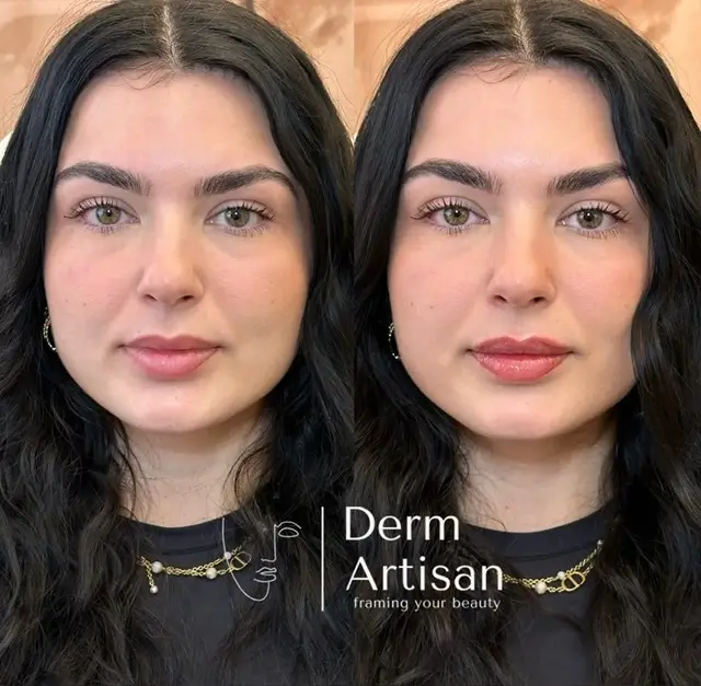 Home 31 photo-output_4