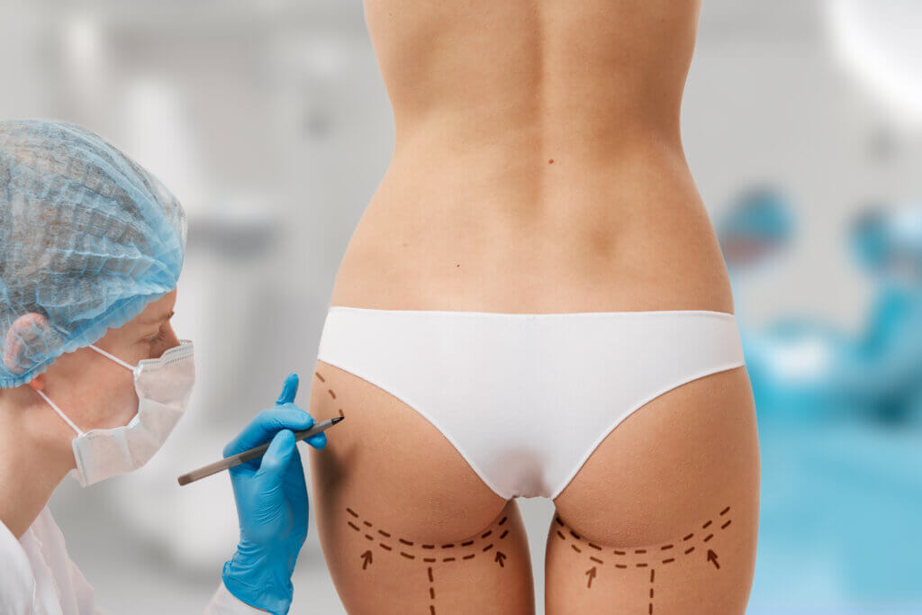 Butt Vacuum NYC: The Non-Invasive Booty Boost