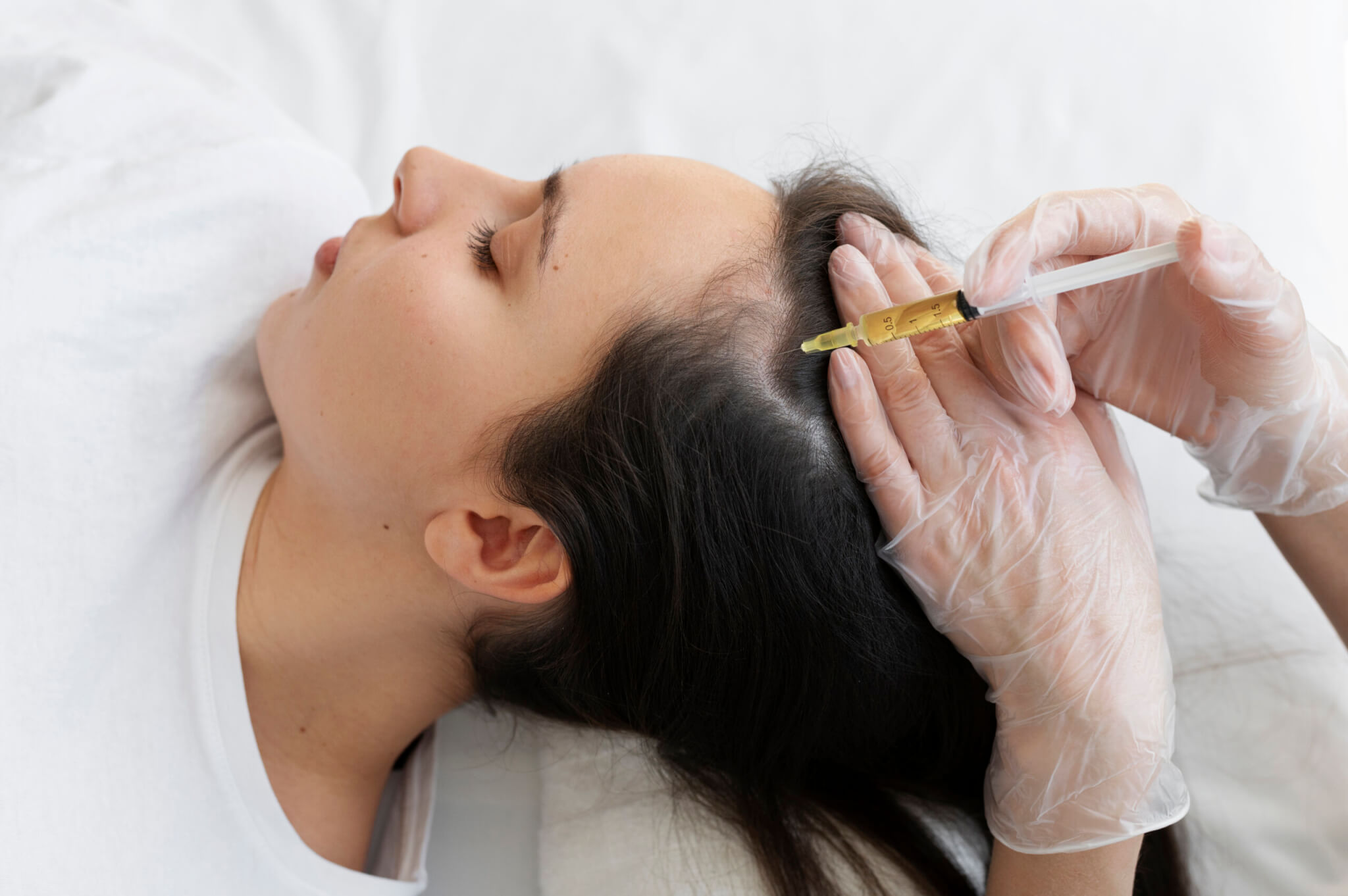 How PRF & Exosomes Restore Hair Naturally