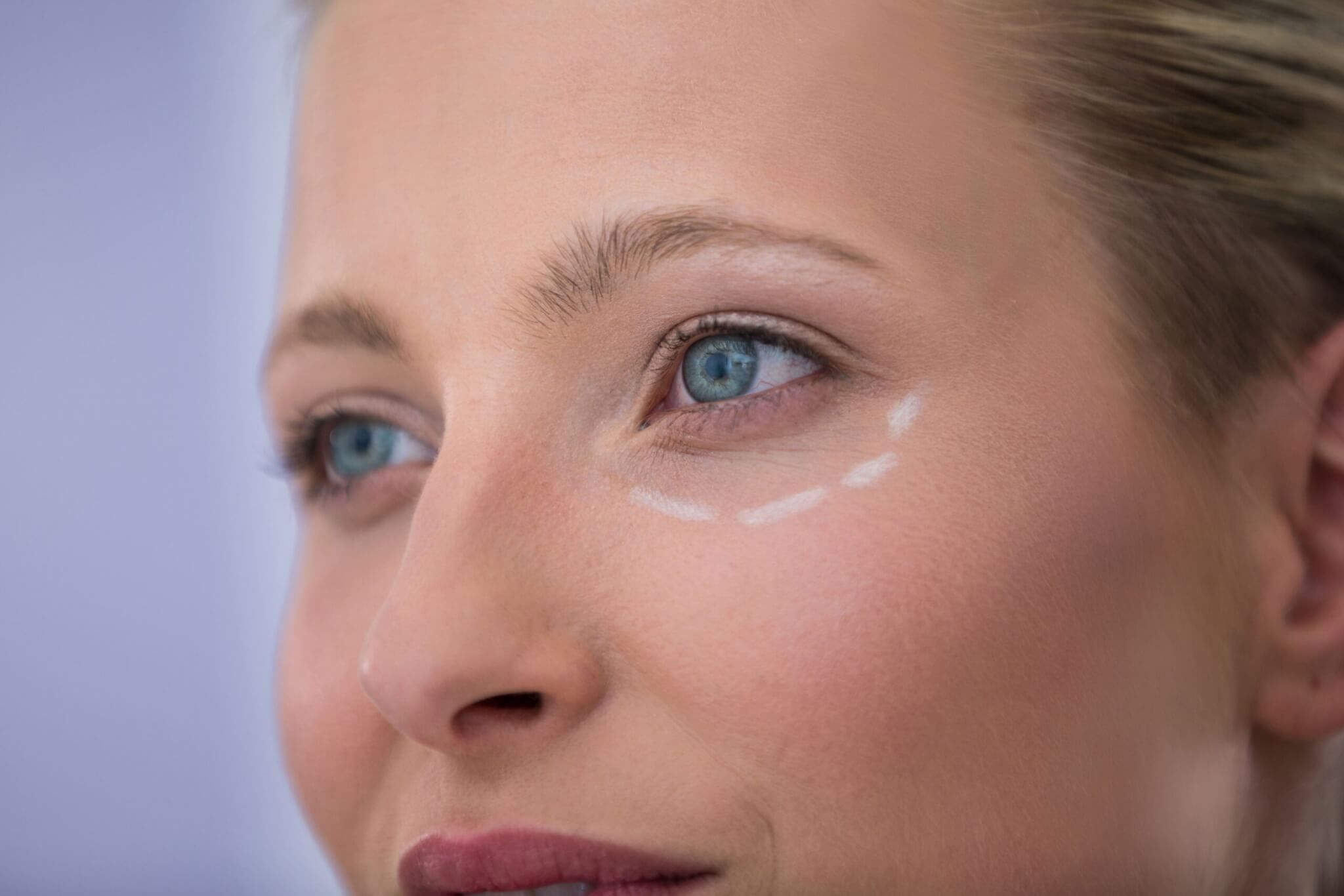 How to Get Rid of Bags Under Your Eyes