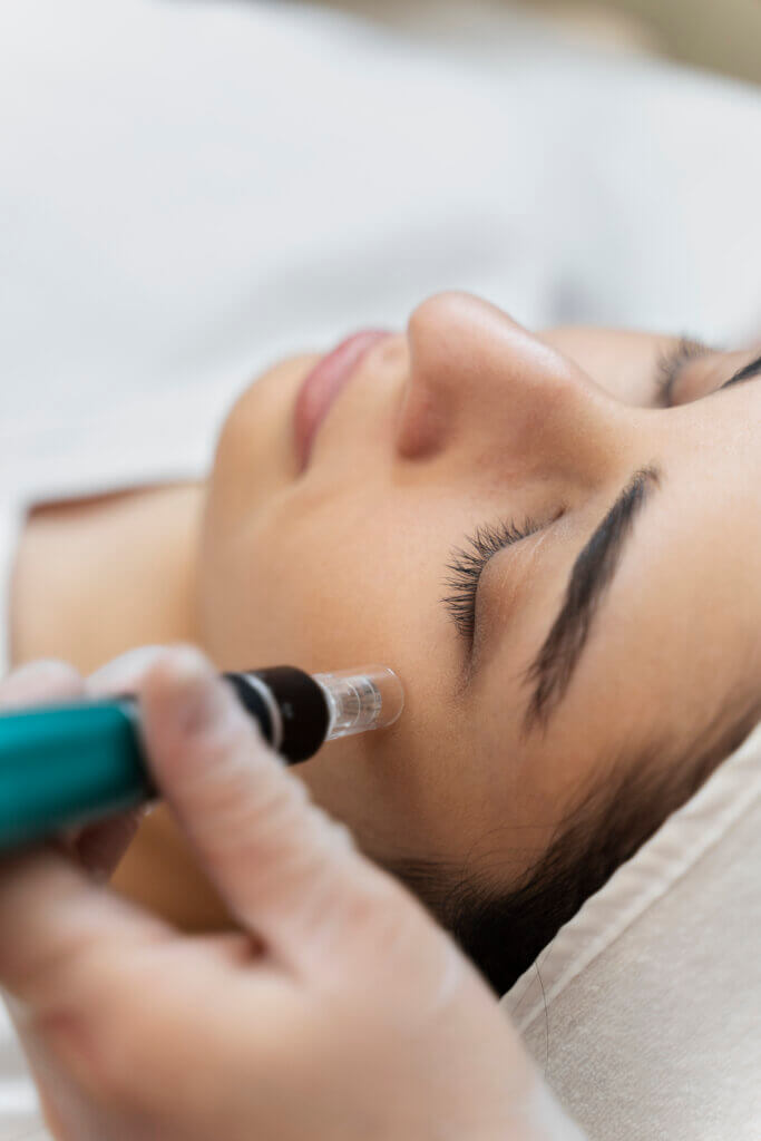 RF Microneedling Alternatives in NYC 1 RF Microneedling Alternatives in NYC